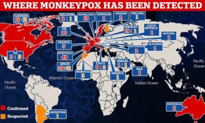 Monkeypox: Outbreak Toll Hits 90 As Virus Recorded In Wales & Northern Ireland
