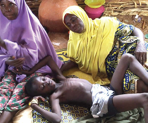 Meningitis killed 190 in 2023, says FG